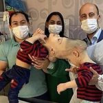 Médicos entrenados con realidad virtual lograron separar con éxito a dos gemelos siameses unidos por la cabeza