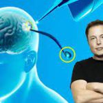 La empresa de Elon Musk implantó por primera vez un chip cerebral en un ser humano